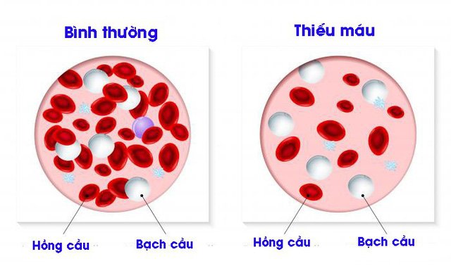 xét nghiệm huyết học là gì